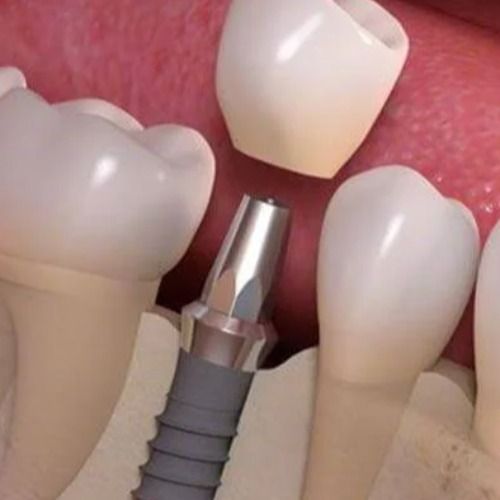 Dr. Marcelo Soria Vizuete, Dentista en Quito Norte | Agenda una cita online